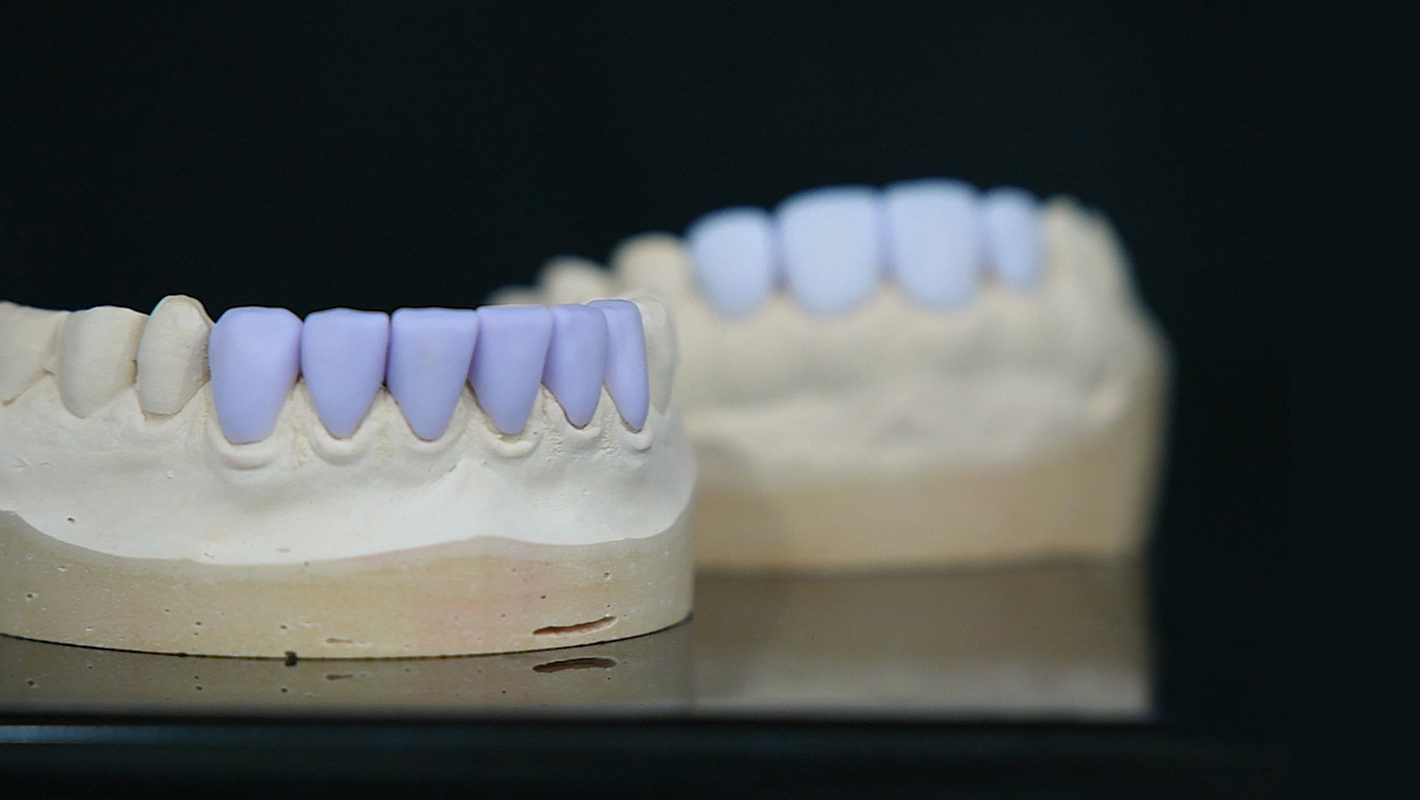 Complete the Perfect Same-Day Digital Workflow with Lilivis