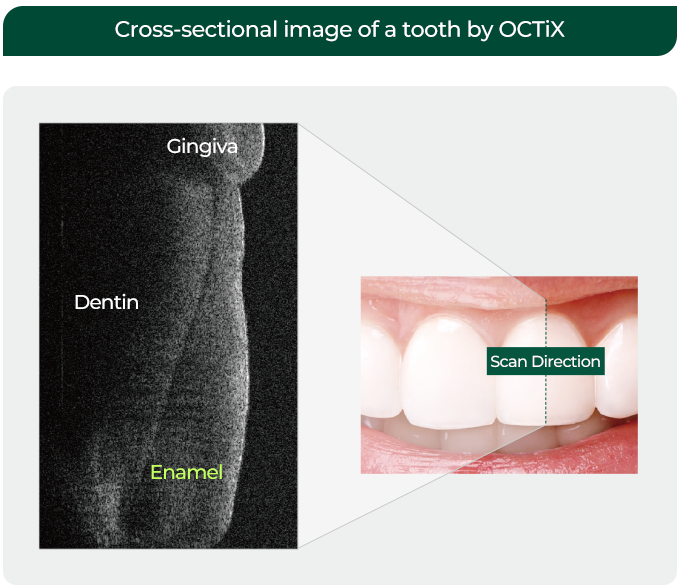 Cross-sectional image of a tooth by OCT / Gingiva / Dentin / Enamel / Scan Direction 