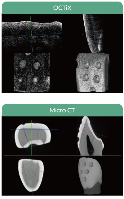3D / LSO-100(OCT) / Micro CT / Before Prep. / Micro CT / Measured Point / Lilivis / 976.4μm / 953.8μm 