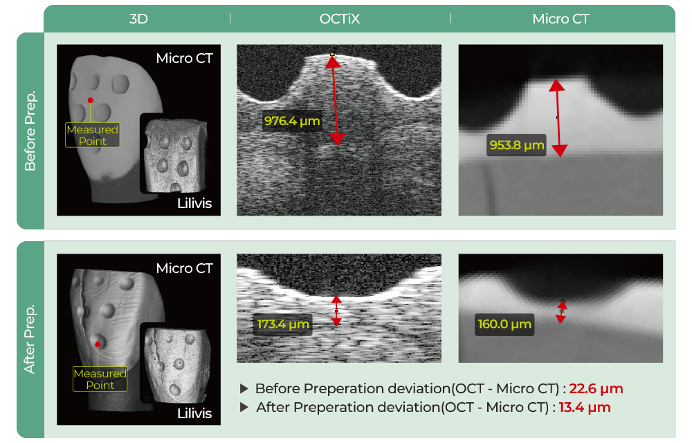 3D / LSO-100(OCT) / Micro CT / Before Prep. / Micro CT / Measured Point / Lilivis / 976.4μm / 953.8μm 