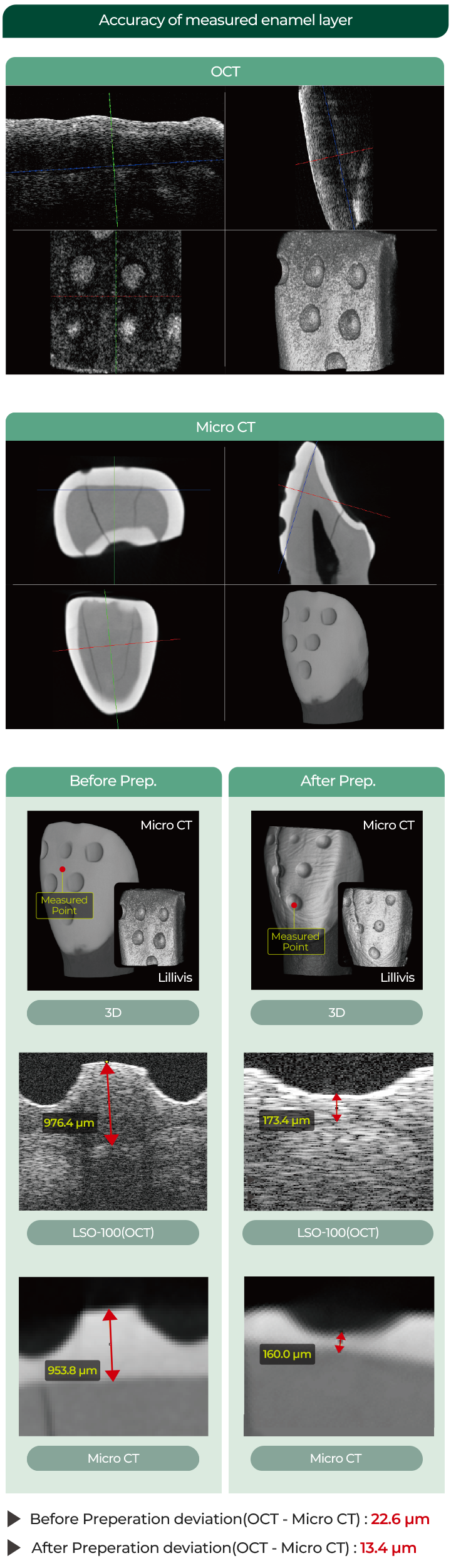 3D / LSO-100(OCT) / Micro CT / Before Prep. / Micro CT / Measured Point / Lilivis / 976.4μm / 953.8μm 
