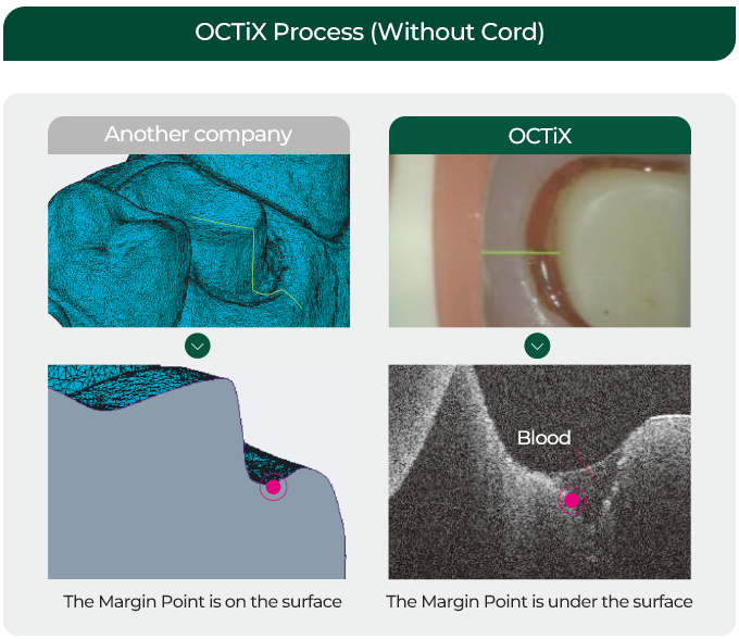 OCT Scan Process(Without Cord) / Another company / The Margin Point is on the surface / Lilivis / Blood / The Margin Point in under the surface