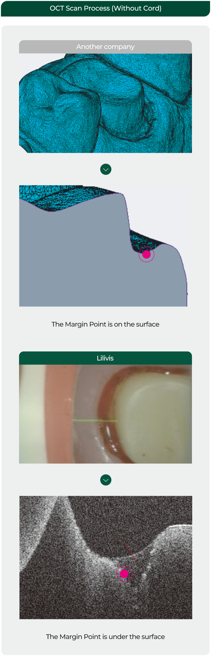 OCT Scan Process(Without Cord) / Another company / The Margin Point is on the surface / Lilivis / Blood / The Margin Point in under the surface